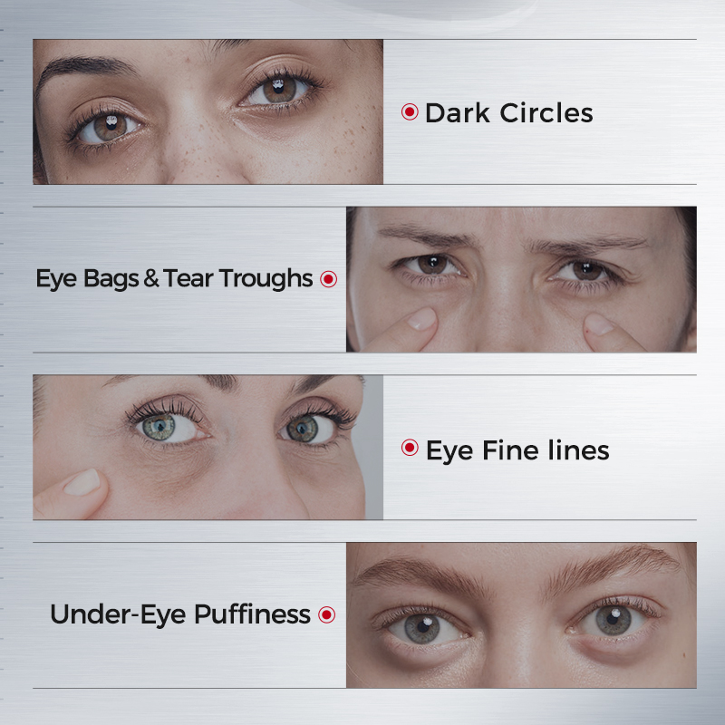 Eye Patches for Dark Circles – - огляд і ціна Collagen Under Eye Patches