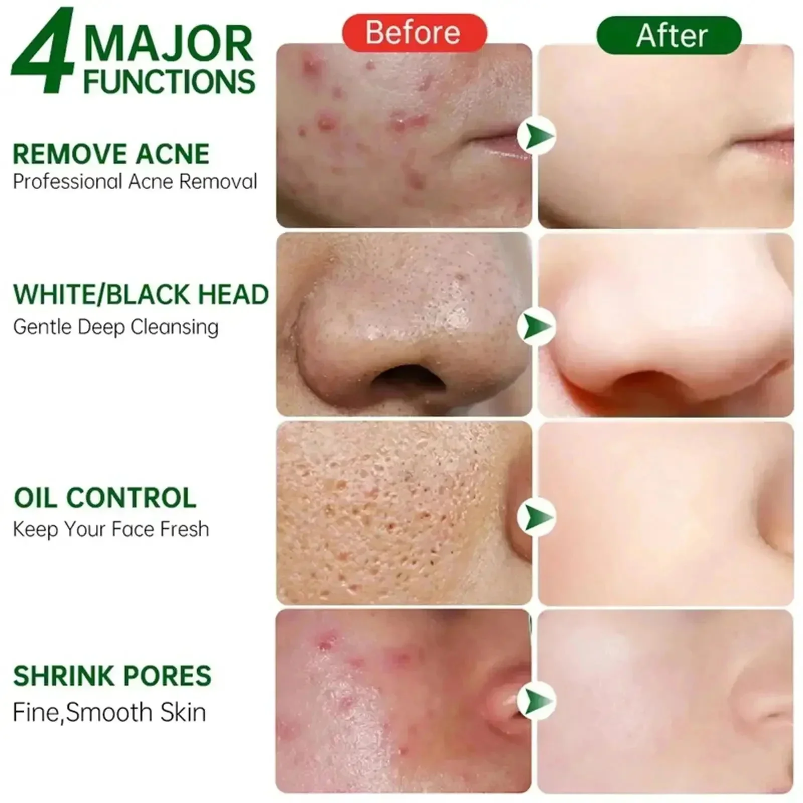 Salicylic Acid Pore Clearing C - огляд і ціна Salicylic Acid Blackhead Remover