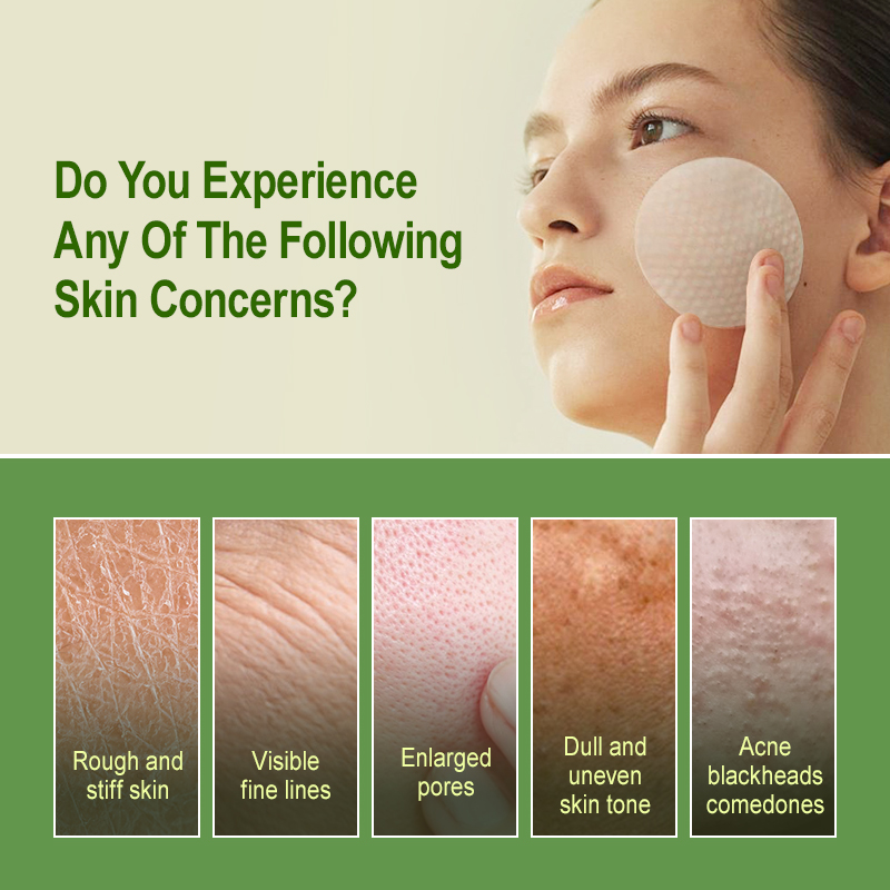 Salicylic Acid Exfoliating Pad - огляд і ціна Salicylic Acid Blackhead Remover